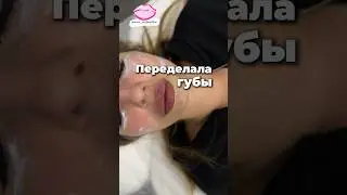 Почему филлер мигрирует из губ 