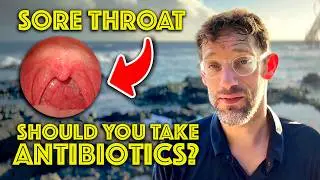 Should You Really Take Antibiotics for Your Sore Throat? - CENTOR criteria - Dr Gill