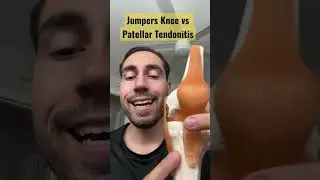 Jumpers knee vs patellar tendinitis (differences) #shorts