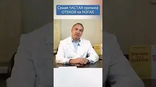 ОТЕКАЮТ НОГИ : что делать?