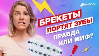 Портят ли брекеты зубы - ПРАВДА ИЛИ МИФ?// #медси #ортодонтия #брекеты