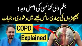 COPD Chronic Obstructive Pulmonary Disease Explained In Urdu Hindi - Dr Irfan Azeem