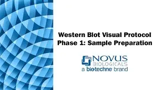 Western Blot Visual Protocol: Phase 1: Sample Preparation