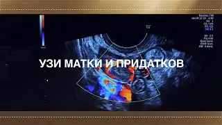 УЗИ МАТКИ И ПРИДАТКОВ