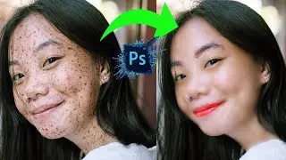 High End Skin Retouching In Photoshop | How to Clean face in photoshop