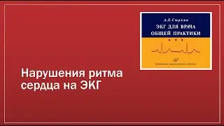 ЭКГ 3. Аритмии