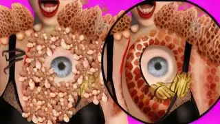 ASMR Ticks & Maggots Remove | Severely Injured Animation | Satisfying.