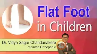 Flat foot in Children | Dr Vidya Sagar Chandanakere | Pediatric Orthopedic | Hi9