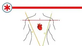 ECG  Electrodes and Leads