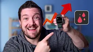 Apple Watch FINALLY Got a Glucose Monitor!