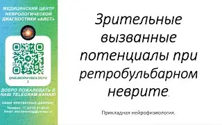 Тема: Зрительные вызванные потенциалы при ретробульбарном неврите.