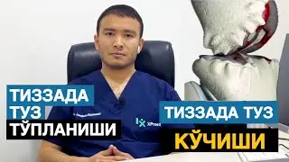 Тиззада туз тупланиши кучиши суяк емирилиши тиззада огрик сабаби тизза артрозини даволаш ☎️881150300