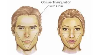 Facial Feminization: Systematic Review– Jeffrey H. Spiegel, MD, FACS