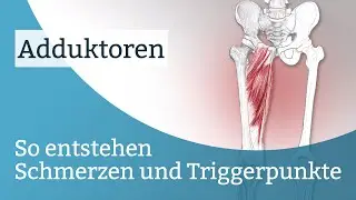 Adduktoren Schmerzen, Triggerpunkte und deren Aktivierung