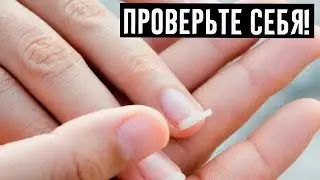 Если у вас слоятся и ломаются ногти, то организм умоляет о помощи!