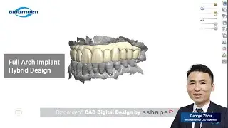 Full Arch Implant Hybrid Design by 3shape