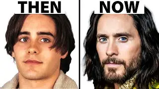 Jared Leto Mystery: Plastic Surgeon's Analysis of His Unchanging Face