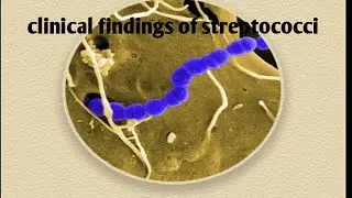 clinical findings of streptococci | part 1