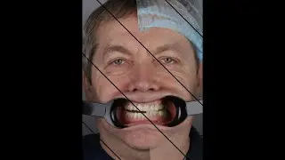 Dental Photography Video Course (How create animated videos)