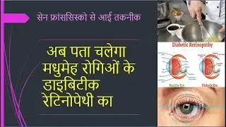 Google Can Now Detect Diabetic Retinopathy Accurately  | NEW TECHNOLOGY 2019 | what's new