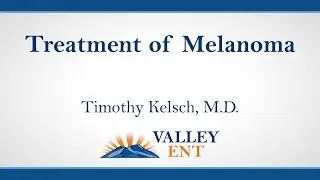 Treatment of Melanoma - Dr. Timothy Kelsch