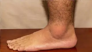 why does my foot feel like it needs to crack