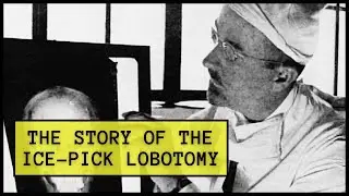 Walter Freeman, and the Story of the Ice-Pick Lobotomy