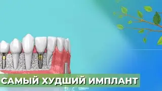 Какие имплантаты не советуют☘️