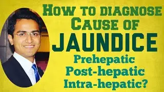 Jaundice Diagnostic Workup - Causes, Symptoms & Treatment