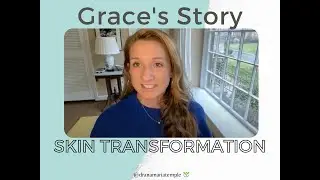 Skin Transformation Testimonial - Grace