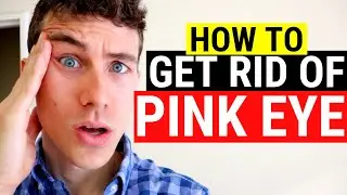 🔴 How to Get Rid of Pink Eye | 3 Must Know Facts About Pink Eye and Conjunctivitis