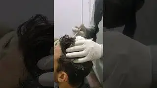 #shortvideo #prphairtreatment@# (PRP) #hairlossprevention Platelet Rich Plasma for hair fall#@$@@