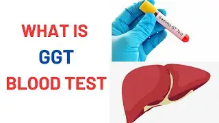 What is GGT Blood Test? Normal Levels, Liver Health