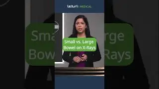 🔎 Small vs. Large Bowel: X-Ray Clues! #Radiology #Gastroenterology #USMLE