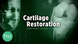 Cartilage Restoration - Everything you need to know