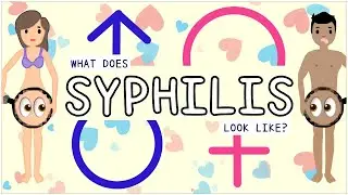 Syphilis: Types, Sign and symptoms, Diagnosis, Treatment