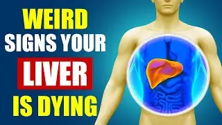 13 Weird Signs You Have Liver Damage