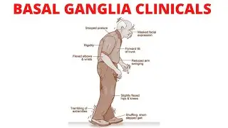 The Basal Ganglia Clinical Anatomy | Parkinson’s Disease | Chorea | Huntington Disease