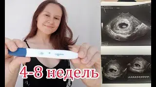 4-8 Недель Беременности. Первое УЗИ. Токсикоз. Отслойка