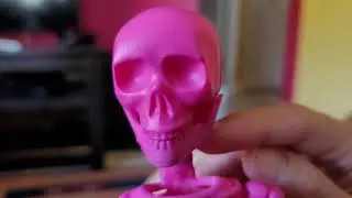 Not the Pink Skeleton!