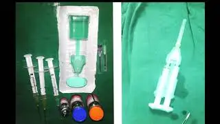 AIOC2018 - VT195 - Novel Use of Fibrin Glue in Sealing Extended Scleral Flap in Manual SICS