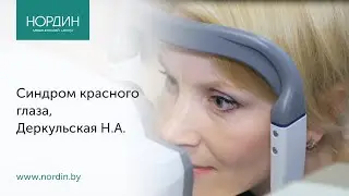 Красные глаза от компьютера? И синдроме красного глаза офтальмолог в Минске