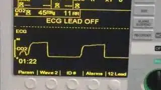 Zoll ETCO2 inservice