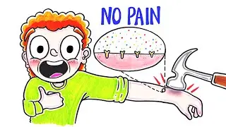 Gingers Can't Feel Pain Properly - THIS IS WHY!