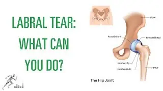 Labral tear of the hip: What is it, and how can you get better?