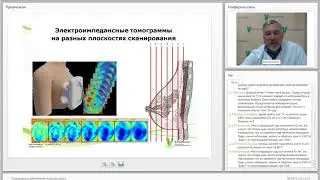 Профилактика заболеваний молочных желёз