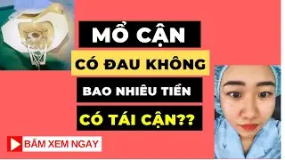Mổ mắt đau không? Bao nhiêu tiền? Mổ cận lasik? Có HỐI HẬN Không?