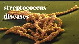 Streptococcus diseases | group A streptococci