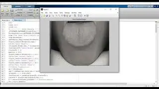 Automated tongue diagnosis using Clustering based Image Segmentation