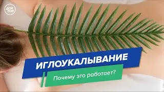 Иглоукалывание. Как это работает?